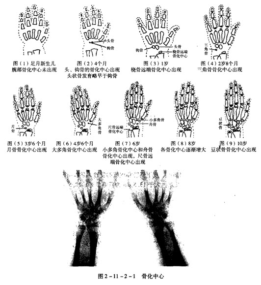 童长骨干骺端骨化中心的